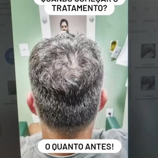 Descubra soluções personalizadas para queda de cabelo, calvície e problemas capilares. Somos especia