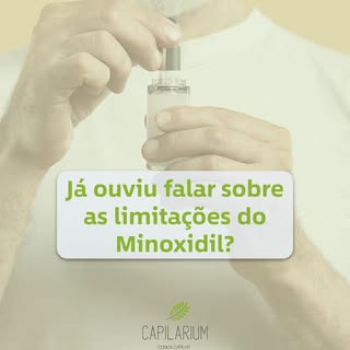 O minoxidil é conhecido como um medicamento vasodilatador periférico, ou seja, ele provoca a dilataç