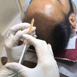 Hair treatment.wid best results...