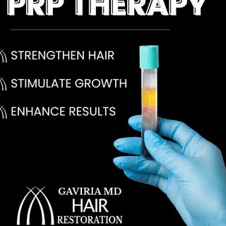 I’ll be honest: if someone tells you PRP alone will cure your hair loss, don’t believe it.

Our pati