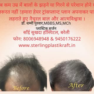 Dr Shammi Purwar, MBBS,MS,MCh Plastic Surgery (IMS, BHU,Varanasi)
Plastic & Cosmetic , Lasers, Hair 