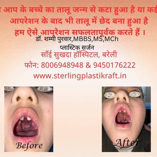 Dr Shammi Purwar, MBBS,MS,MCh Plastic Surgery (IMS, BHU,Varanasi)
Plastic & Cosmetic , Lasers, Hair 