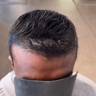 Using your own hairline and adding a hair piece just looks… right;  a natural blend that actually fe