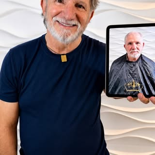 12 meses de transformação. E olha esse resultado!

Um ano depois do transplante capilar, o resultado