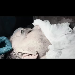 #drmudassirmahboobplasticsurgeon
