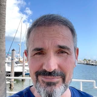It’s the fifth month after the surgery. I have another 7 months for density to keep coming in. Very 