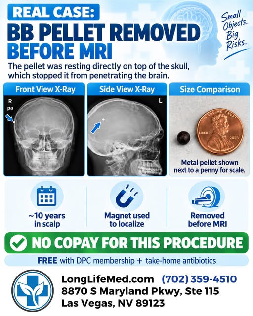 𝗧𝗵𝗶𝘀 𝗕𝗕 𝗽𝗲𝗹𝗹𝗲𝘁 𝗵𝗮𝗱 𝗯𝗲𝗲𝗻 𝗯𝘂𝗿𝗶𝗲𝗱 𝗶𝗻 𝗵𝗶𝘀 𝘀𝗰𝗮𝗹𝗽 𝗳𝗼𝗿 𝗮𝗯𝗼𝘂𝘁 𝟭�