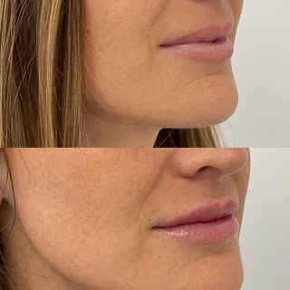 A little volume. A little definition. A beautifully balanced result. 💋

This before & after is all 