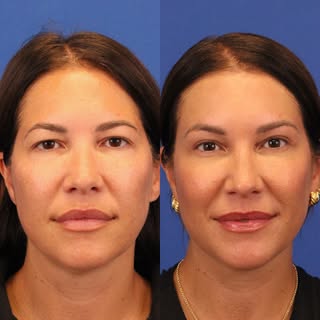 There is something so special about a result that makes people notice how refreshed you look without