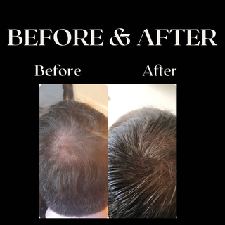 Before & After 

Hoe vet is dit? Kale plekjes zijn ingeruild voor een mooi vol resultaat. Say Hello 