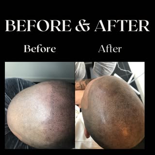 BEFORE & AFTER

Weer een duidelijk en mooi resultaat. Wat vinden jullie van het resultaat? Word jij 