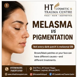 Melasma hai ya simply pigmentation? 🤔
Har dark patch melasma nahi hota!

Melasma, post-acne pigment