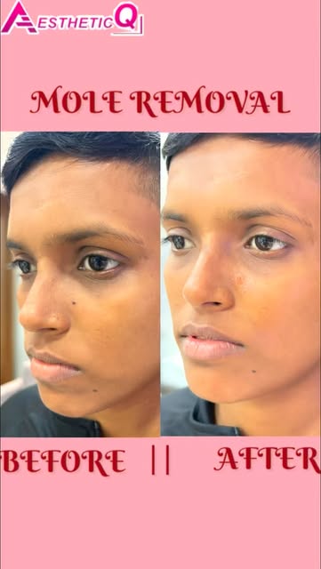 aestheticqindia Real Results Actually Matters .
From glowing skin to healthy hair, we provide a wide