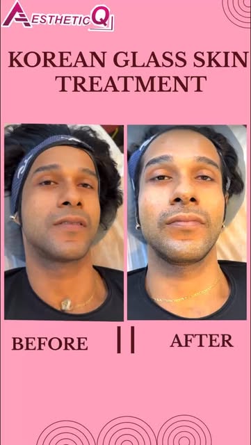 clients.
Real results. Real stories. Real confidence.
From glowing skin to healthy hair, we provide 