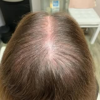 Before and After. Want to see what we can do for you? Reach out.