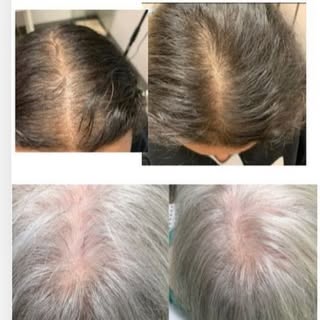 My favorite dry scalp tips, in no particular order:
 
Water won’t magically hydrate your scalp. Drin