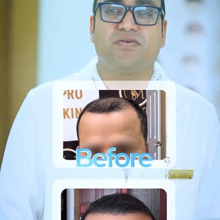 Everything you wanted to know about hair transplants 👨‍⚕️
We sat down with Dr. Mohan answer your to