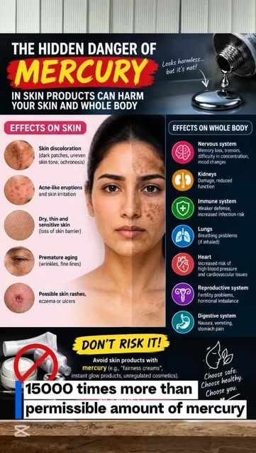कतै Mercury (पारा) , lead (सिसा)र steroid (स्टेरोइड) मिसिएको क्रिमले तपाईंको अनुहार स्थायी रूपमा बिग