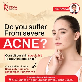 😣 Struggling with severe acne?
💆‍♀️ Consult our skin specialist for acne-free, glowing skin!
✨ Get