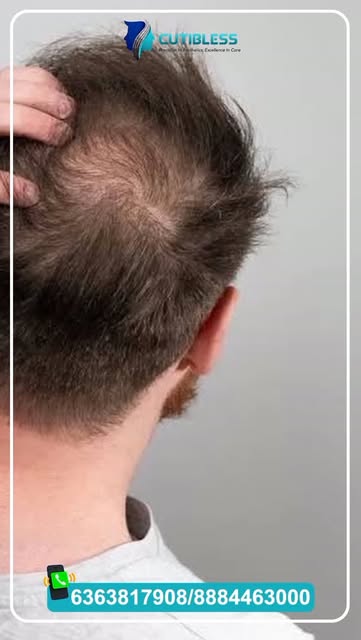 Hair Loss? It’s Time to Understand the Cause. ✨
Hair fall, thinning, and receding hairlines can happ