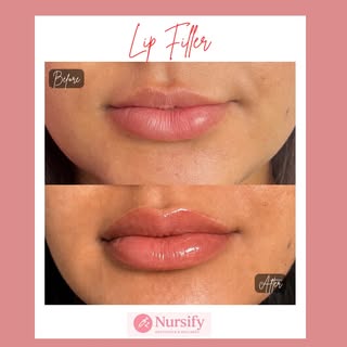 Just a little balance can make such a beautiful difference 💋✨

This sweet client wanted to enhance 