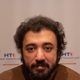 Meet Mohsin..

After being involved in a traffic accident last year, Mohsin sadly lost the hair from