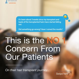 Seeing your transplanted hairs shed after 2–4 weeks can be alarming... but it’s completely normal.

