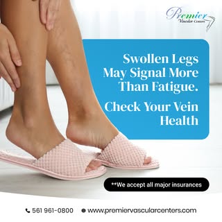 Persistent swelling, heaviness, or skin changes in your legs should never be ignored. Early treatmen