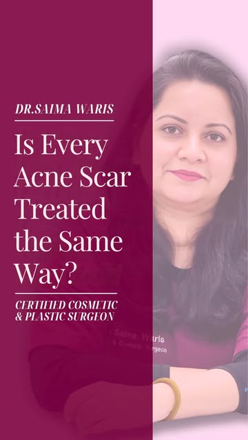 Is Every Acne Scar Treated the Same Way? - Is Every Acne Scar Treated the Same Way?

This content is