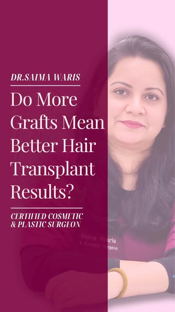Zyada Grafts Ka Matlab Zyada Behtar Result Hai? - Do More Grafts Mean Better Hair Transplant Results