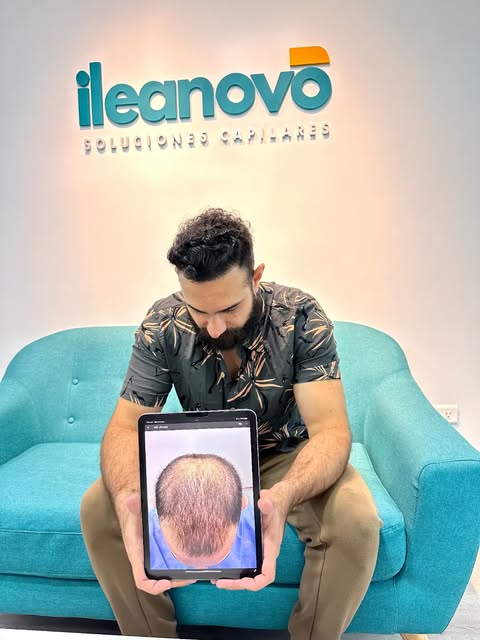¿Tienes pérdida de cabello? 

Imagínate dentro de 6-12 meses, y la caída sigue su curso.. 
El moment