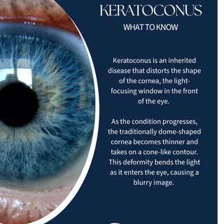 Keratoconus can change the way you see the world, literally.

This progressive eye condition causes 