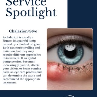 A chalazion and a stye may look similar, but they’re not quite the same. 👁️

A chalazion is typical