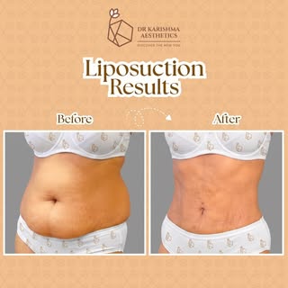 ✨ Sculpt Your Confidence. Reveal the Best Version of You. ✨

Every transformation is unique, and thi