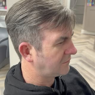 Hair loss transformation on @francisgilbride. Now available at Robert Byrne Hairdressing Navan. A gr