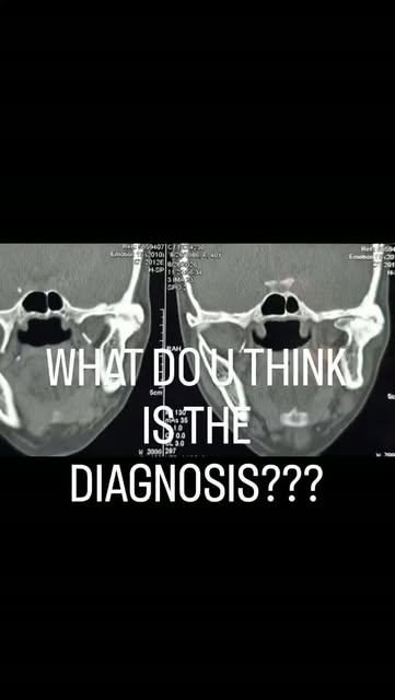 What do u think is the Diagnosis and how do u treat it?? Full case coming soon...
