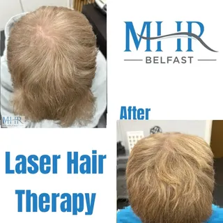 ✨️ More hair, more confidence ✨

If you’re noticing thinning, increased shedding or less volume, now