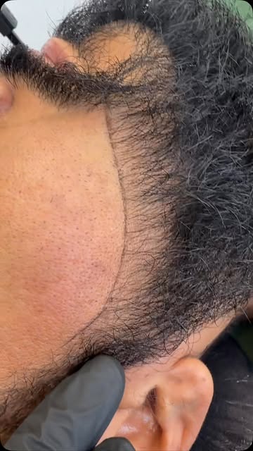 No buscamos cambiar tu barba, sino mejorar lo que ya tienes. 🔥

En este caso realizamos una marcaci