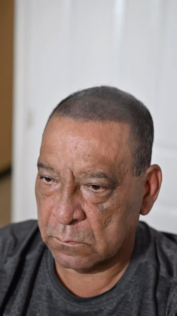 No todos los casos de densidad capilar necesitan rapado. Este cliente conservó su cabello frontal y 