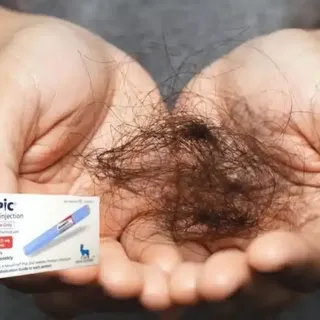 Weight-Loss Injections & Hair Loss: Is There a Connection? 💉💇‍♀️

👉One of the most common questio