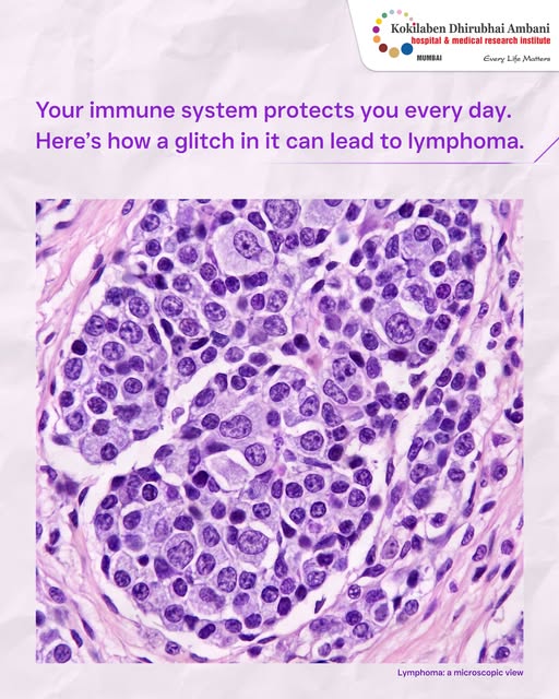 Your body’s defence system can sometimes need support too.

Lymphoma is a cancer that affects the ce