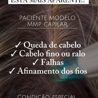 Queda de cabelo, falhas ou fios cada vez mais finos?

Estamos selecionando pacientes modelo para MMP
