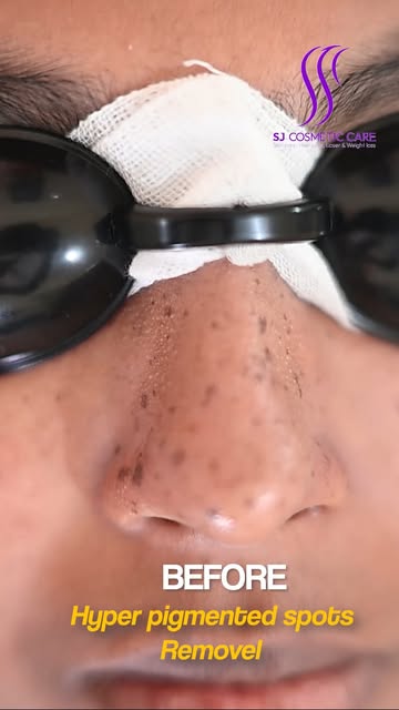 Say goodbye to stubborn dark spots and hello to clear, even skin! ✨

📍 SJ Cosmetic Care
🏠 C.B.H Ro