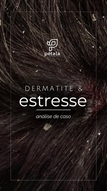Seu couro cabeludo piora quando você está estressado?

Coceira, oleosidade e descamação podem ser si