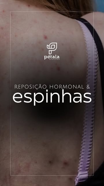 A pele também sente as mudanças hormonais.

Na pré-menopausa, alterações hormonais podem aumentar a 