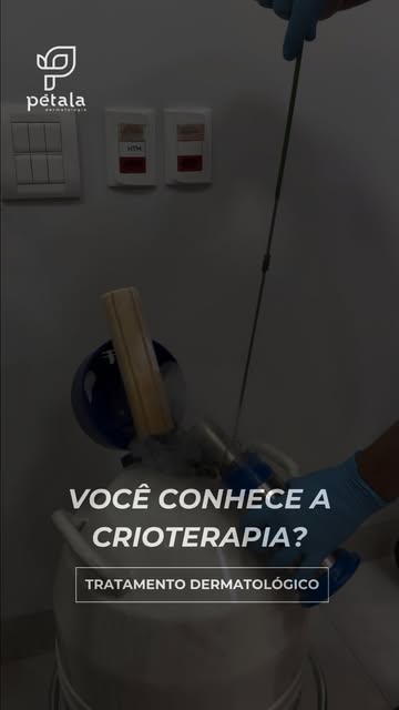 Você já viu como a crioterapia realmente funciona?

A crioterapia utiliza nitrogênio líquido em temp