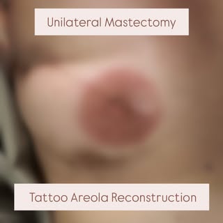 Tattoo Areola Reconstruction✨🎀