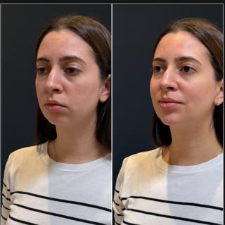 Quando o resultado é muito mais do que só sobre estética… 

É sobre autoestima, confiança, sobre ser