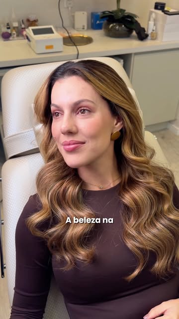 POV: quando está na hora de renovar o botox, você faz uma expressão e a dermato já está marcando os 