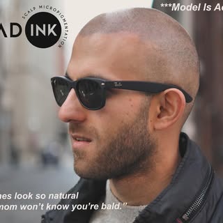 ✔️Confidence unlocked! 💪✨ Thanks to scalp micropigmentation, I’ve rediscovered a level of self-assu